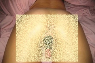 Côte d'Ivoire : Pour relever un défi, une jeune fille introduit une bouteille dans son vagin !